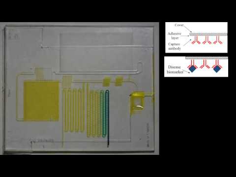 Capillary Driven Microfluidic Circuit for performing one Step Immunoassay